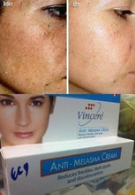 Load image into Gallery viewer, Vin 21 Cream Anti Melasma Reduces Age Spots, Sun Spots, Pigmentation, Freckles 15 G.
