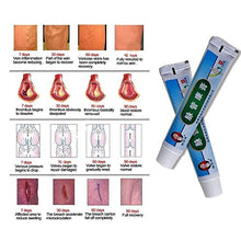 Load image into Gallery viewer, Colorcasa MAIGUAN KANGGAO - Varicose Veins Vasculitis Treatment Legs Care Cream (20g) (2pcs)

