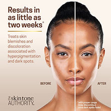 Load image into Gallery viewer, Ambi Skincare Fade Cream for Oily Skin | Dark Spot Remover for Face and Body | Treats Skin Blemishes &amp; Discoloration | Improves Hyperpigmentation | 2 Ounce
